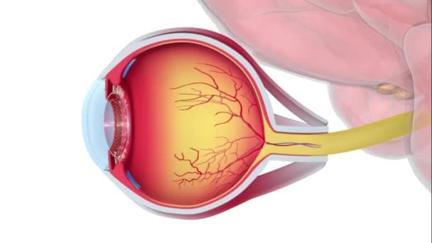 RETINAL SURGERIES